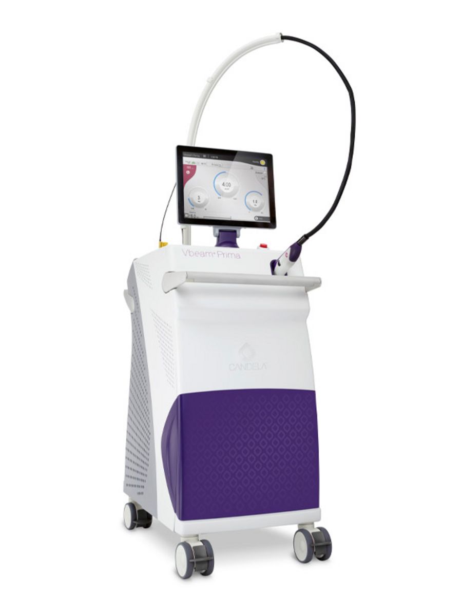 Candela Laser Vbeam Prima